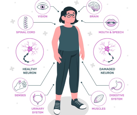 Nerve Problem